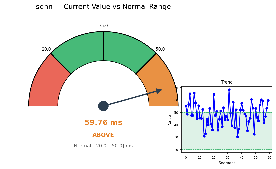 Visualization for sdnn